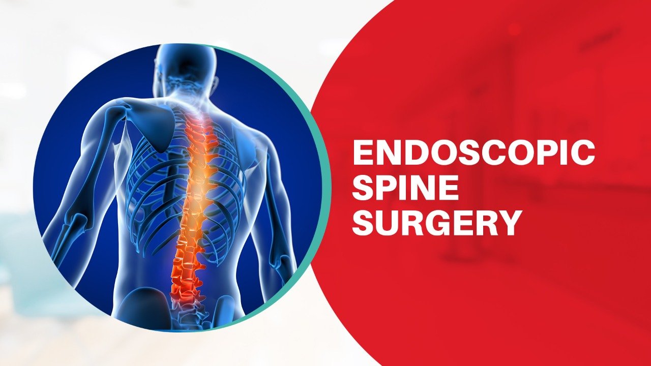 Endoscopic Spine Surgery Jankalyan Hospital